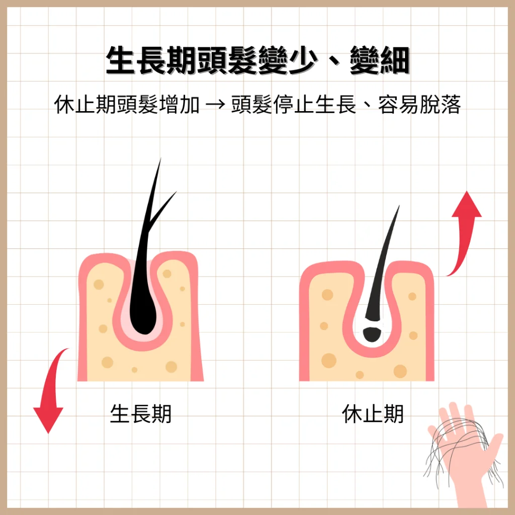生長期頭髮變少、變細，休止期頭髮增加